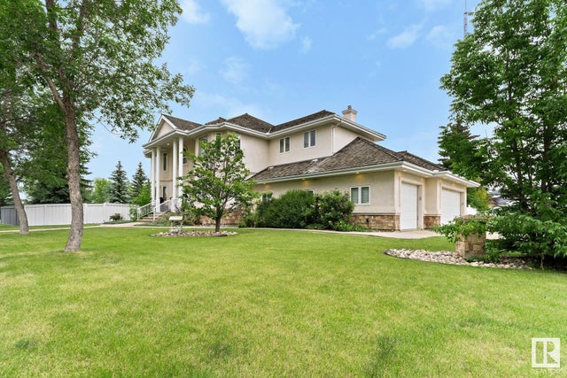 285 Estate Drive, Sherwood Park