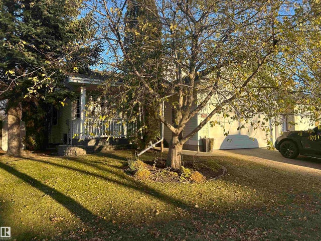 158 Meadowview Drive, Sherwood Park